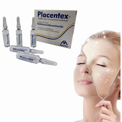3 ml Poly Deoxy Ribo Nucleotide Dermal Fillers για τις ουλές της ακμής